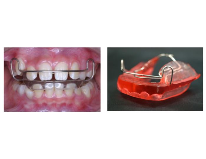 バイオネーター