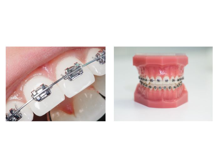 ブラケット装置