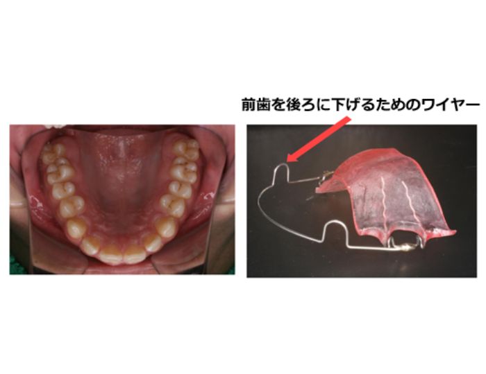 しぼるプレート