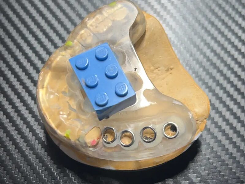 サージカルガイド